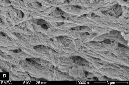 BioOss microstructure agrandissement